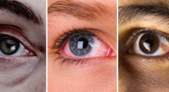 Eye Health : ఈ 8 సూచ‌న‌లు పాటిస్తే మీ క‌ళ్లు సేఫ్‌.. ఎలాంటి స‌మ‌స్య‌లు రావు..!