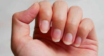 Nails Health : మీ గోర్లు ఆరోగ్యంగా, అందంగా ఉండాలంటే.. వీట‌ని రోజూ తీసుకోండి..!