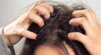 Itchy Scalp Home Remedies : త‌లంతా దుర‌గా అనిపిస్తుందా.. అయితే ఈ 10 చిట్కాల‌ను పాటించండి..!