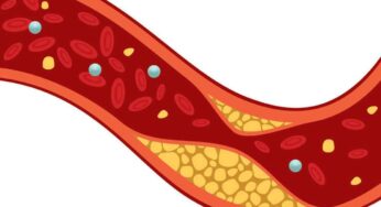 High Cholesterol Symptoms : ఈ ల‌క్ష‌ణాలు క‌నిపిస్తున్నాయా.. అయితే మీ శ‌రీరంలో కొలెస్ట్రాల్ ఎక్కువ‌గా ఉన్న‌ట్లే..!