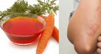 Carrot Oil : చ‌ర్మంపై ఎలాంటి దుర‌ద‌లు ఉన్నా.. జెట్ వేగంతో త‌గ్గిస్తుంది.. ఎంతో ఉప‌యోగ‌క‌రం..