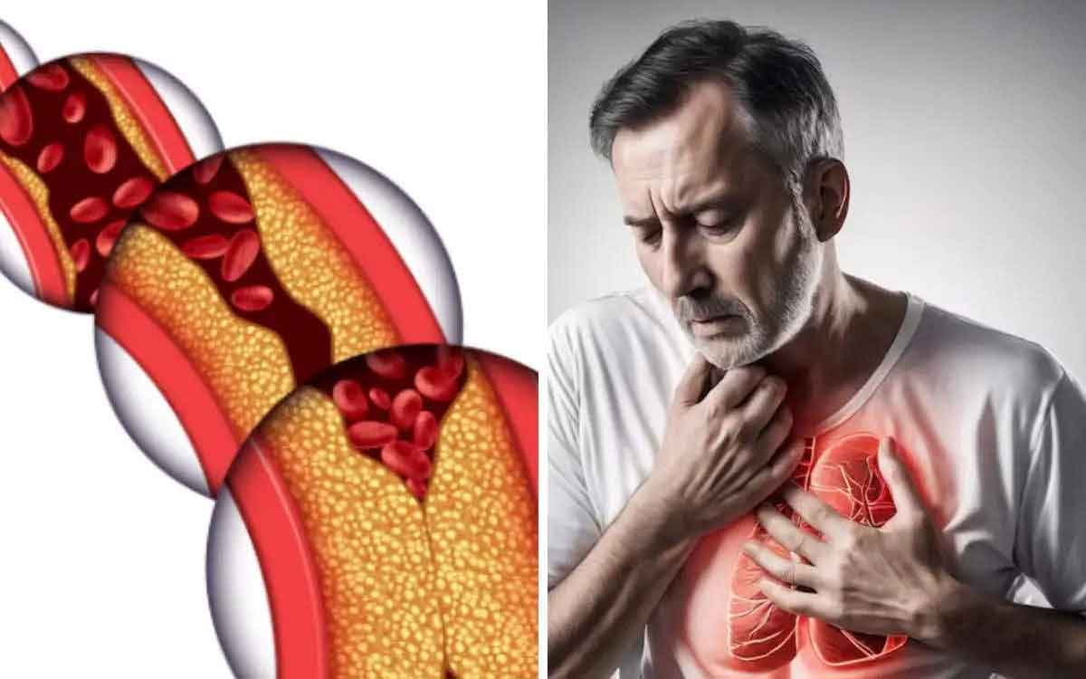 in how many days you will get heart attack according to your cholesterol levels 