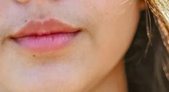 Facial Hair Home Remedies : ఫేషియల్ హెయిర్ తో బాధపడుతున్నారా..? ఇలా చేస్తే మళ్ళీ రాదు.. ఈజీగా రాలిపోతుంది…!