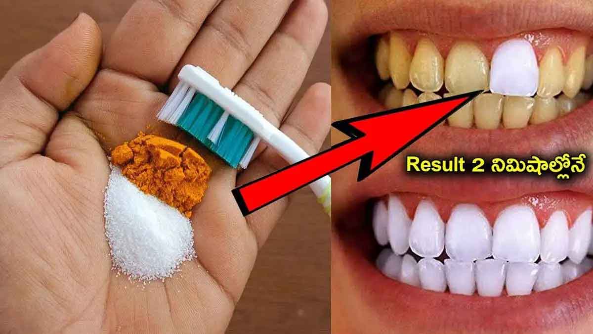 your yellow teeth will become white with this tip