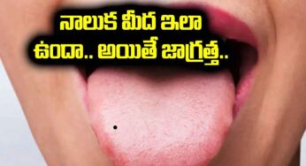 Blackspots On Tongue : నాలుక మీద నల్ల మచ్చలు ఉన్నాయా..? ఇలా సులభంగా తొలగించ‌వచ్చు..!