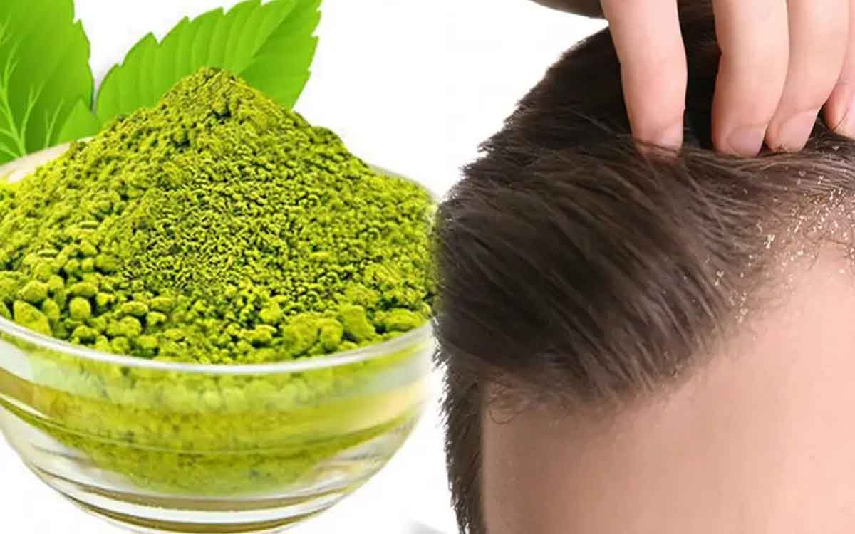 use this mixture to remove dandruff 