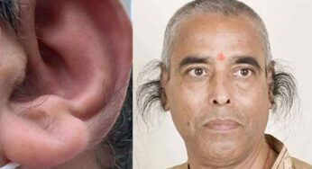 Hair On Ears : చెవిలో వెంట్రుకలు ఉంటే అదృష్టమా..? దురదృష్టమా..?