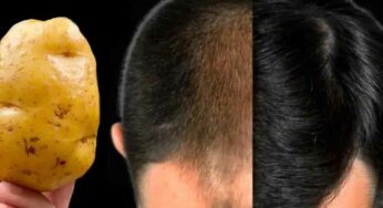 Potato For Hair : ఆలుగ‌డ్డ‌ల‌తో ఇలా చేస్తే చాలు.. పోయిన చోట జుట్టు తిరిగి మొలుస్తుంది..!