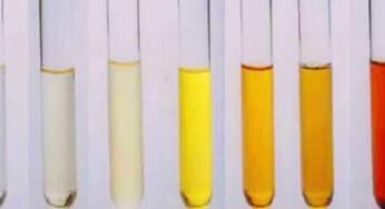 Urine Color : మీ మూత్రం రంగును బ‌ట్టి మీకున్న అనారోగ్య స‌మ‌స్య‌ల‌ను ఇలా తెలుసుకోవ‌చ్చు..!