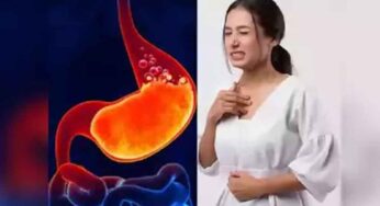 Natural Home Remedies For Acidity : క‌డుపులో మంట‌గా ఉందా.. ఈ స‌హ‌జ‌సిద్ధ‌మైన చిట్కాల‌ను పాటించండి..!