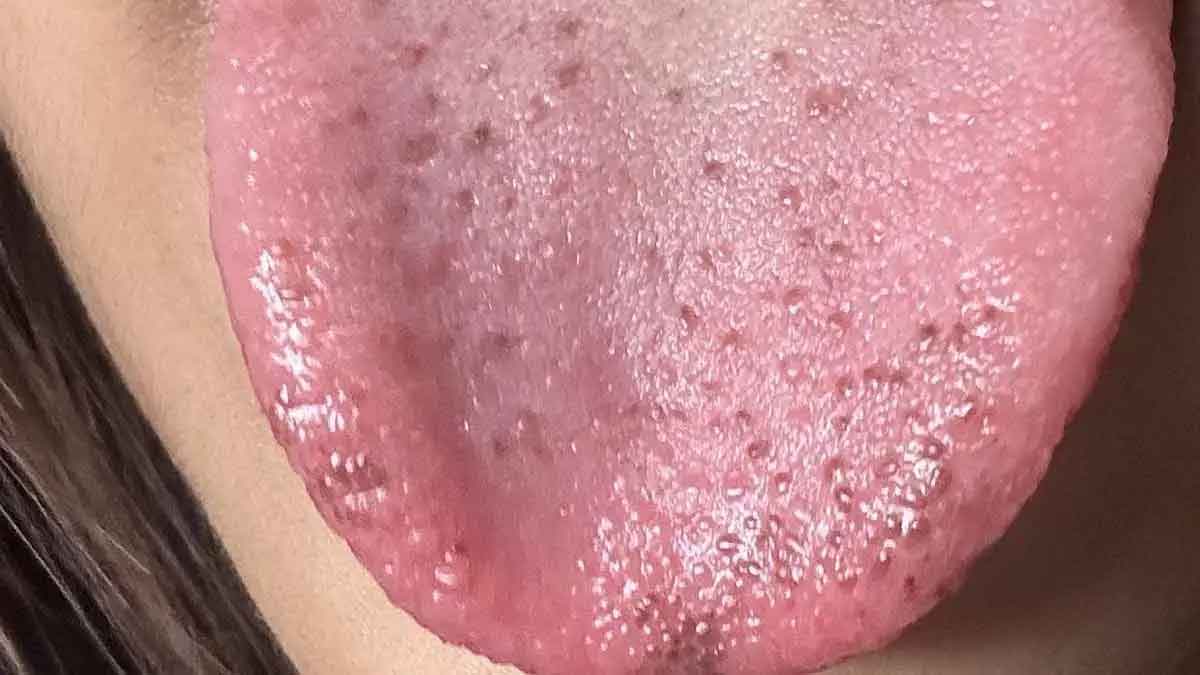 if you have black spots on tongue then beware 