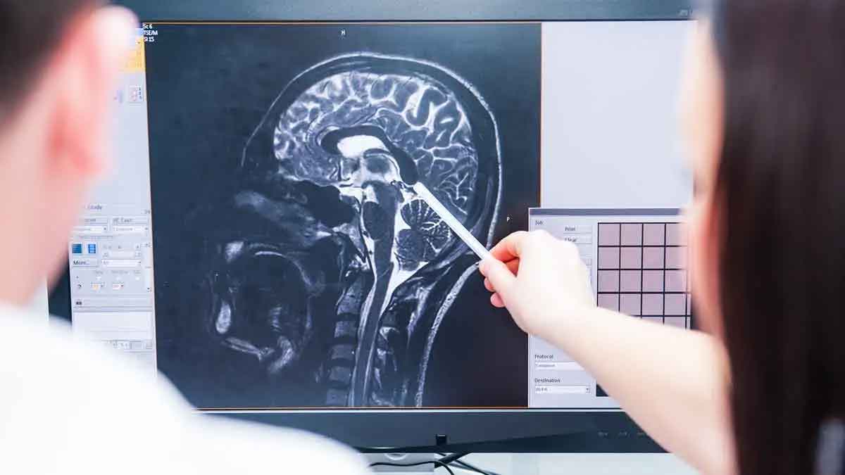 our brain will be active even after our death for about 7 minutes 