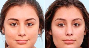 Face Fat : ఈ వ్యాయామాలు చేస్తే చాలు.. మీ ముఖంపై ఉండే కొవ్వు క‌రుగుతుంది..!