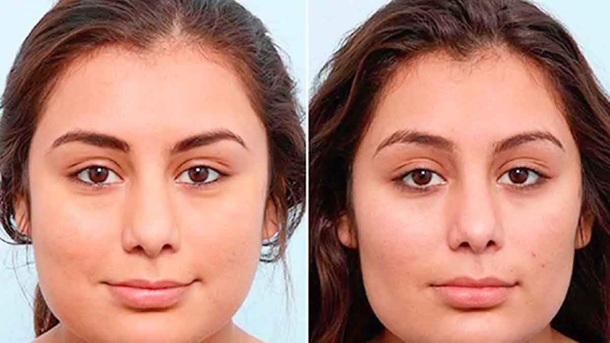 how to reduce face fat follow these tips 