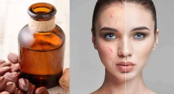 Jojoba Oil For Beauty : ఎంత‌టి న‌ల్ల‌ని స్కిన్ అయినా స‌రే.. ఈ టిప్ చాలు.. తెల్ల‌గా మారుతుంది..!