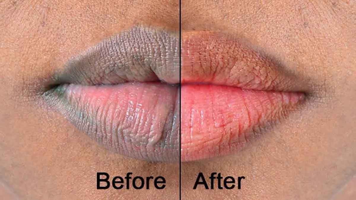 follow these tips for lips beauty 