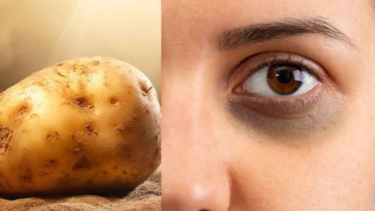 use potato in this way for beauty 