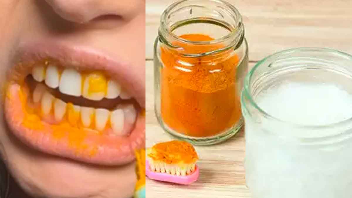 follow these simple home remedies to whiten your teeth 