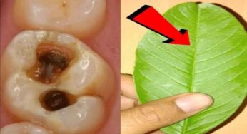 Teeth Pain : ఈ ఒక్క ఆకుతో దంతాల నొప్పి, పిప్పి ప‌న్ను మాయం..!