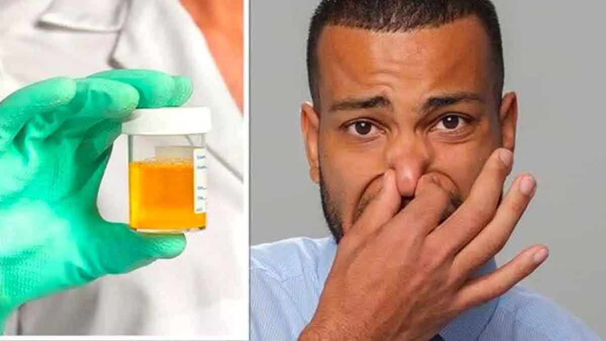 if your urine is getting bad smell then these are the reasons 