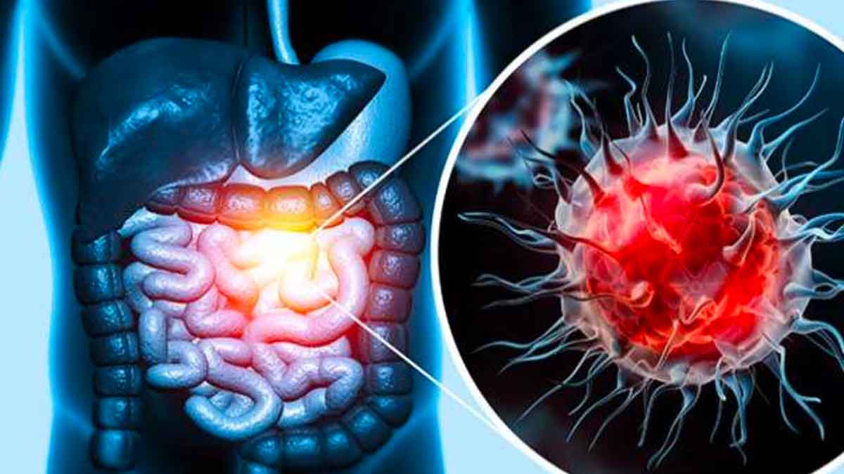 cancer symptoms you must know about 