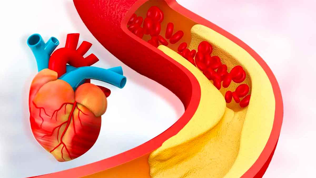 you can reduce cholesterol by following this simple tips