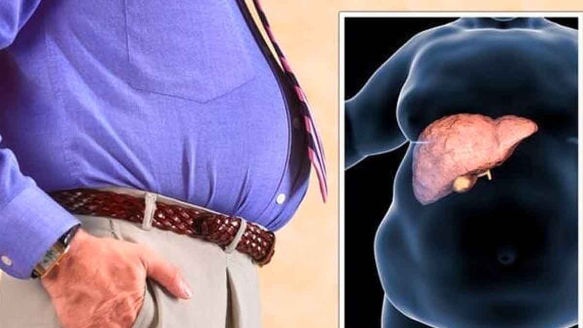 what is fatty liver and what are its symptoms 