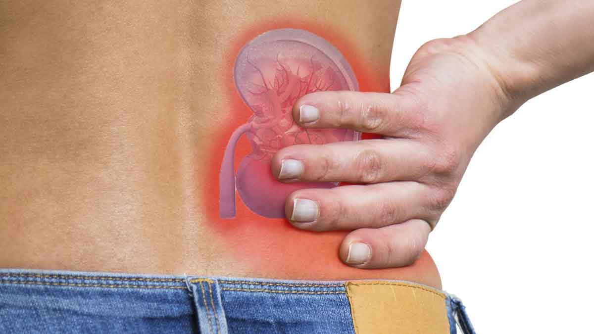 follow these wonderful home remedies for kidneys health 