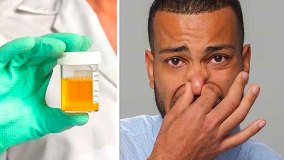 these are the reasons for smelly urine 