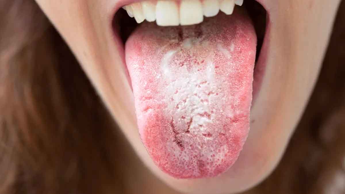 if your tongue is white then these may be the reasons 