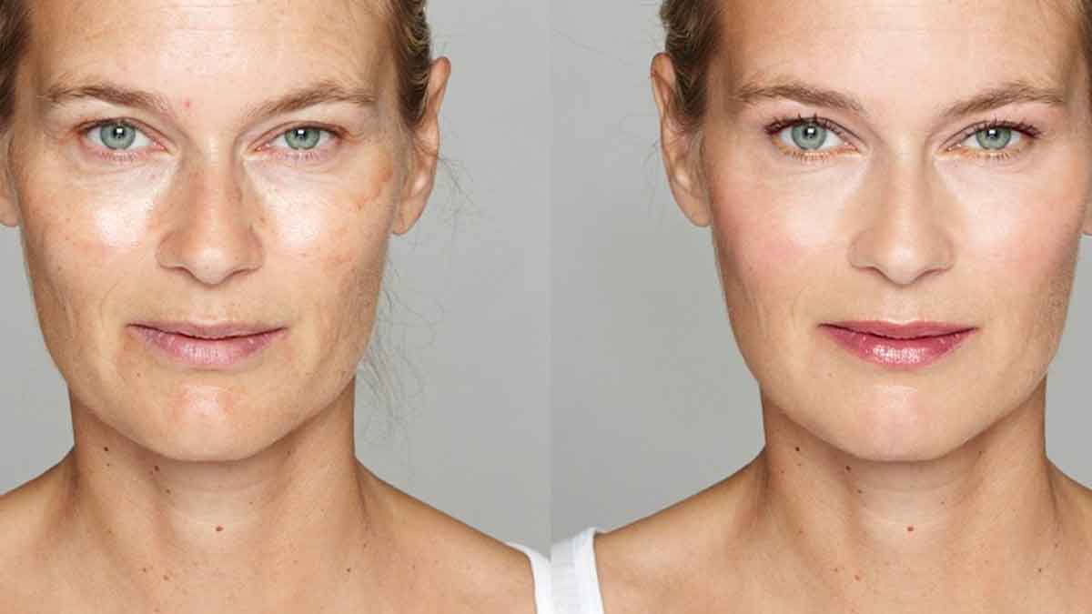 follow these tips for younger look 