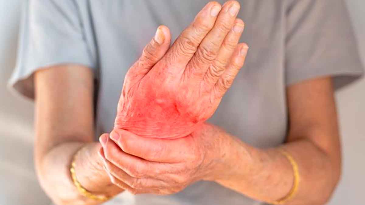 follow these 2 home remedies to reduce arthritis pains 