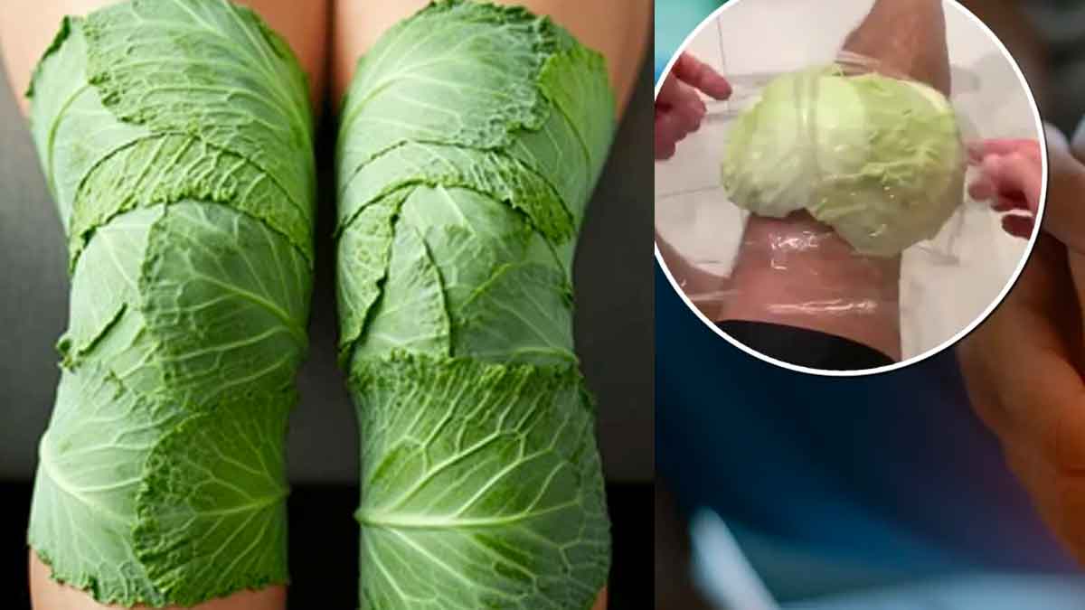 put cabbage leaves on knees for many benefits 