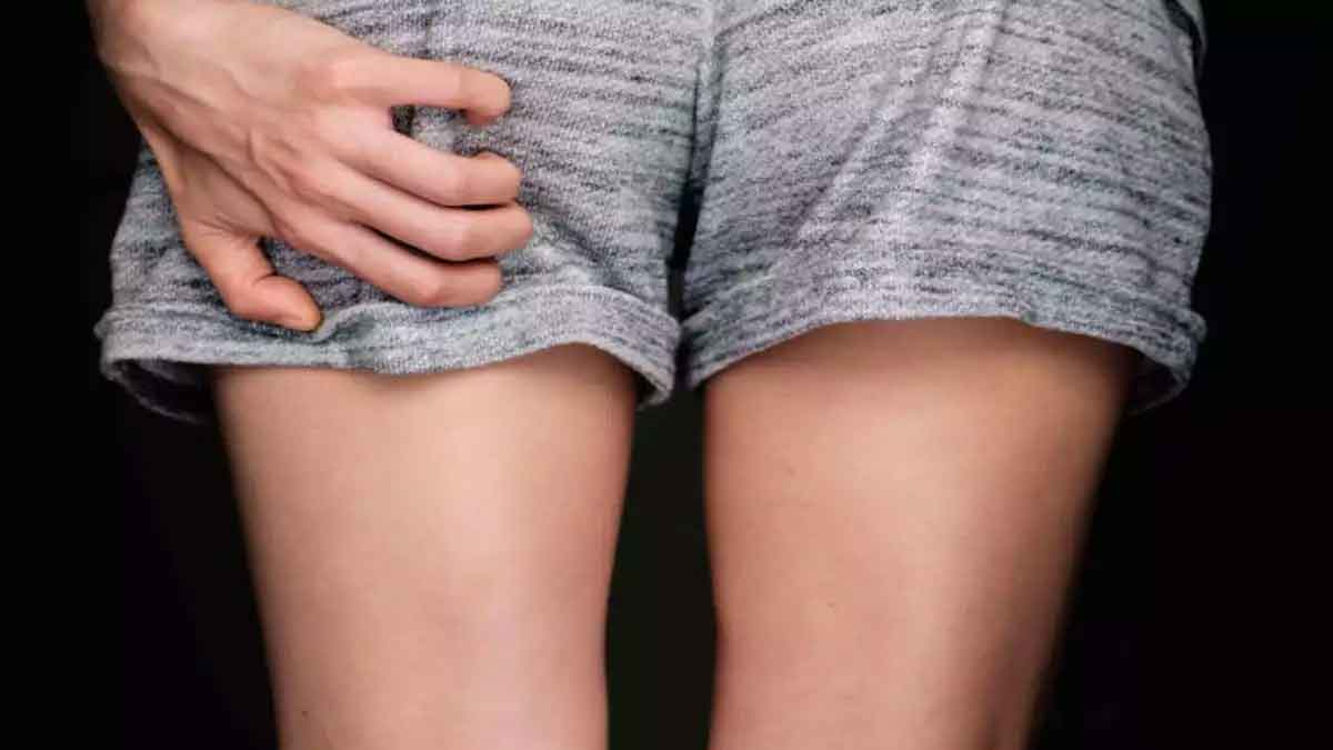 wonderful home remedies to reduce itching buttocks 