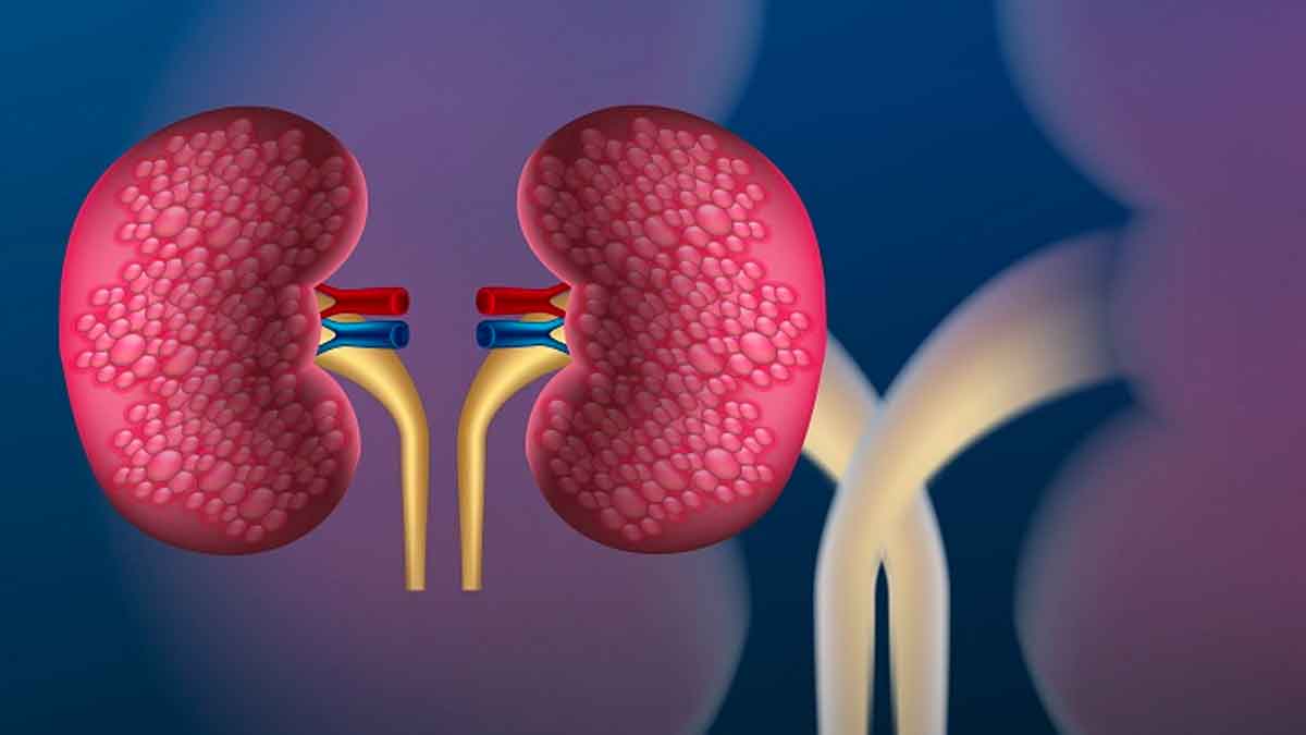 follow these simple tips for kidneys health 