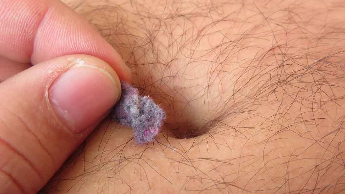 do you know how lint forms in navel 