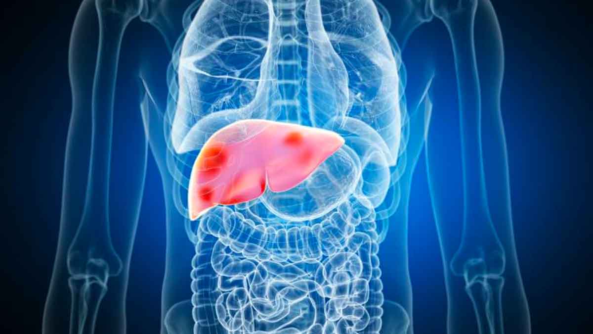 we must clean our liver every 15 days take these 