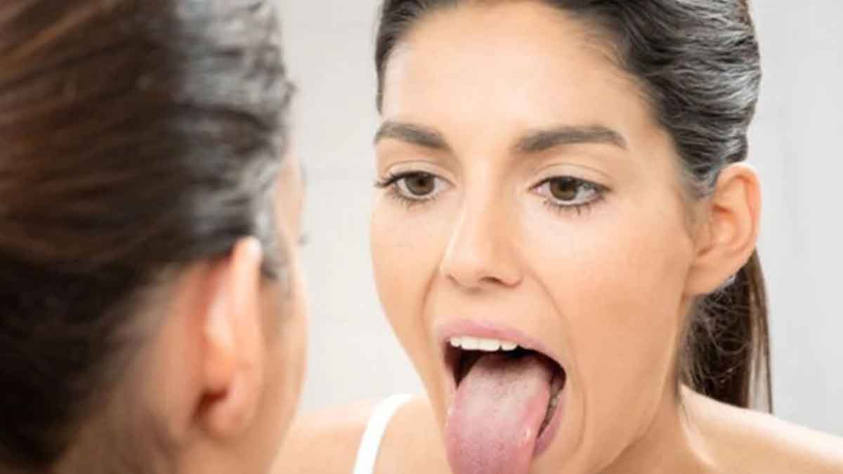 why doctors see tongue when we go to them 