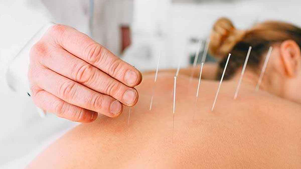 with acupuncture heart attack can be prevented 