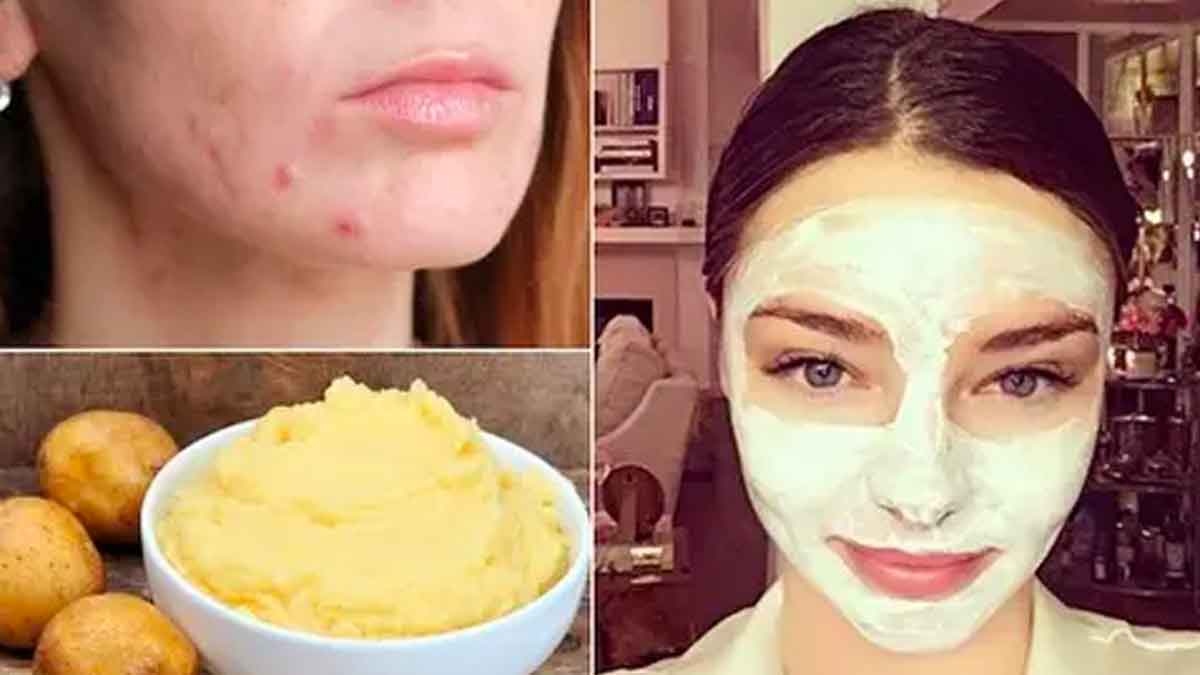 using potato for face gives wonderful health benefits 