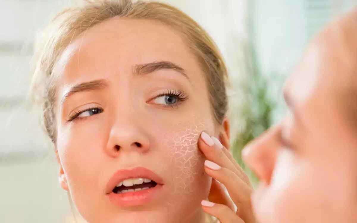 follow these tips if you have dry skin 