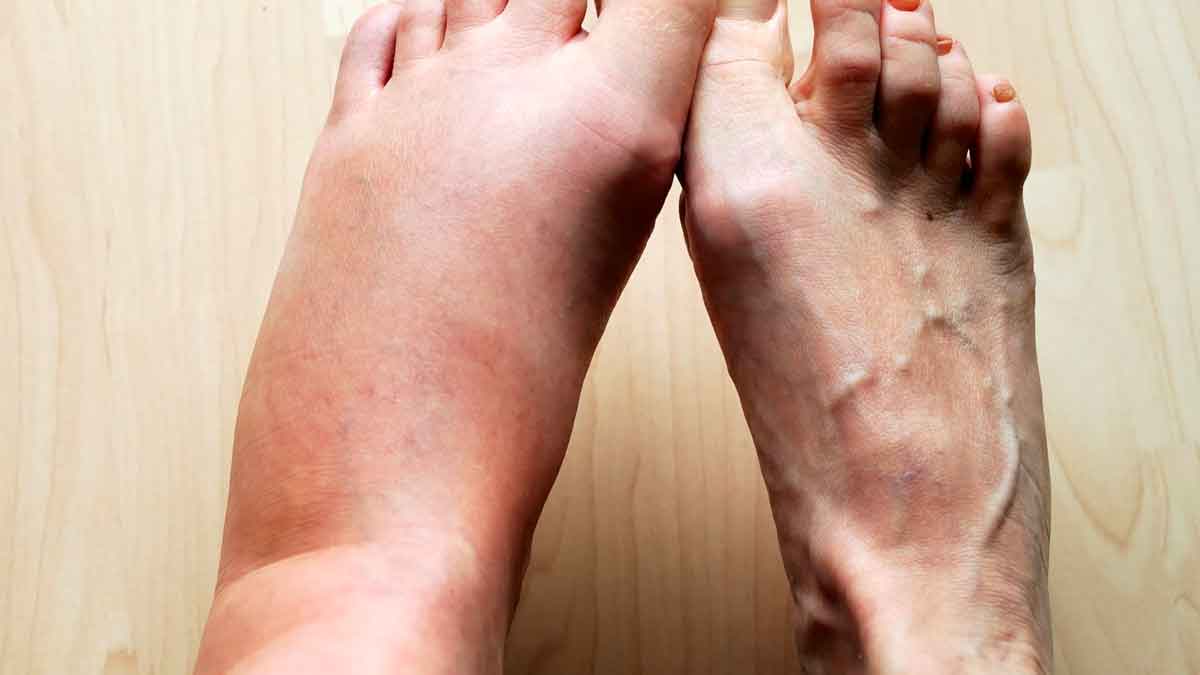 if you have feet swelling then know what it means 