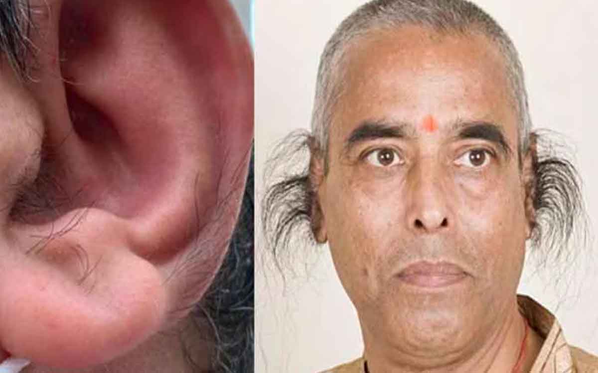 if you have hair on ears then know what happens 