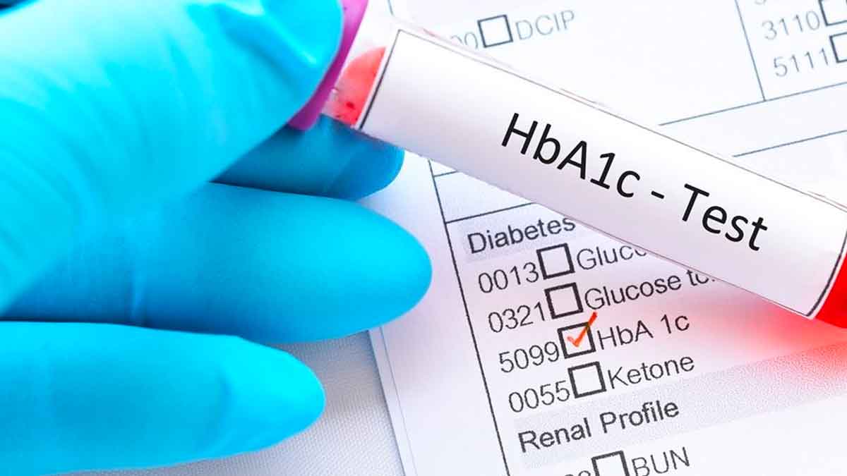 diabetes patients must do hba1c test 