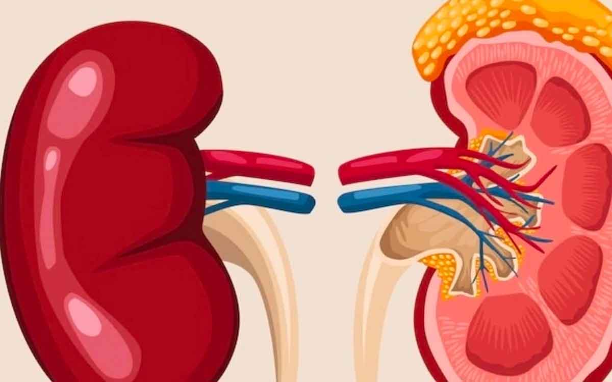 if these symptoms appear in you then your kidneys might be damaged 