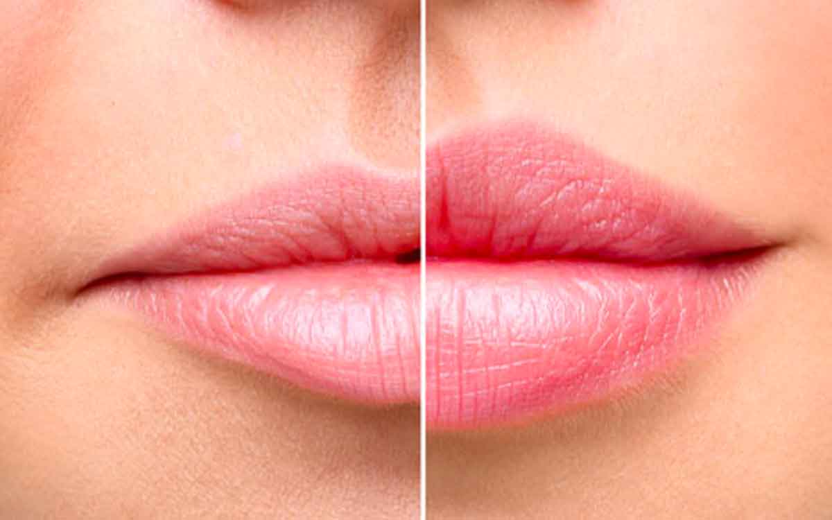 if your lips are drying very much then know why it happens 