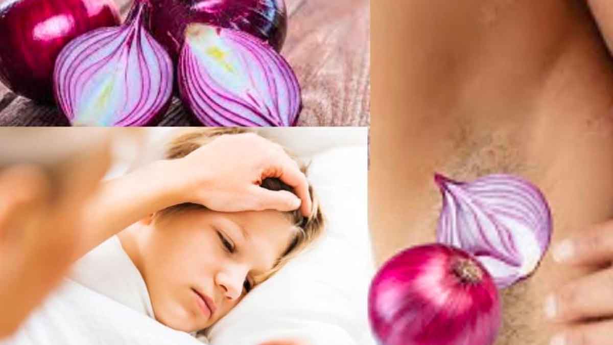 why onion in underarms create fever 