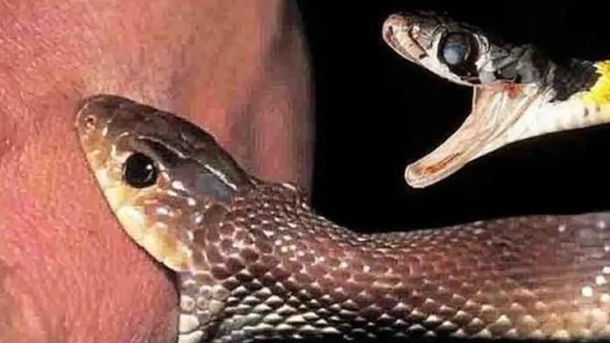 how to survive a snake bite 