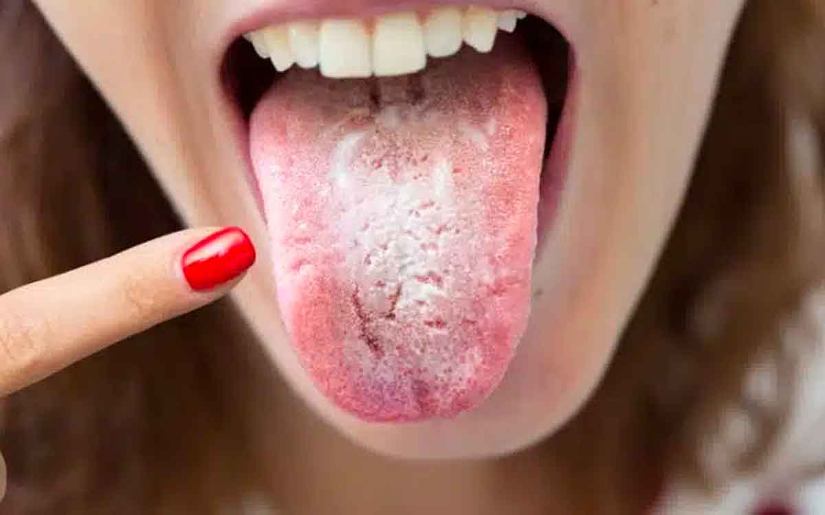 your tongue health can tell which diseases you have 