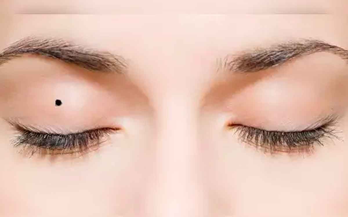 women who have birth marks in these places are lucky 